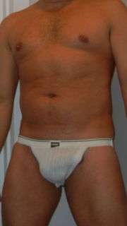 barric